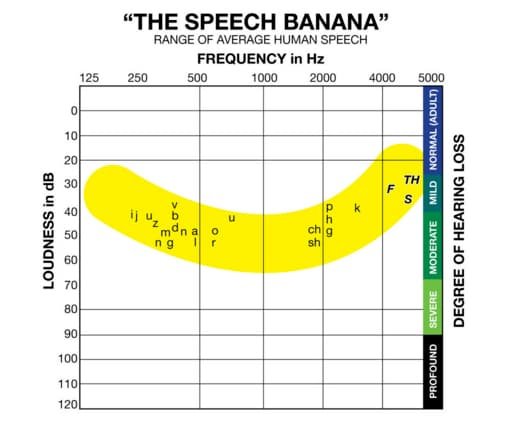 the speech banana audiogram